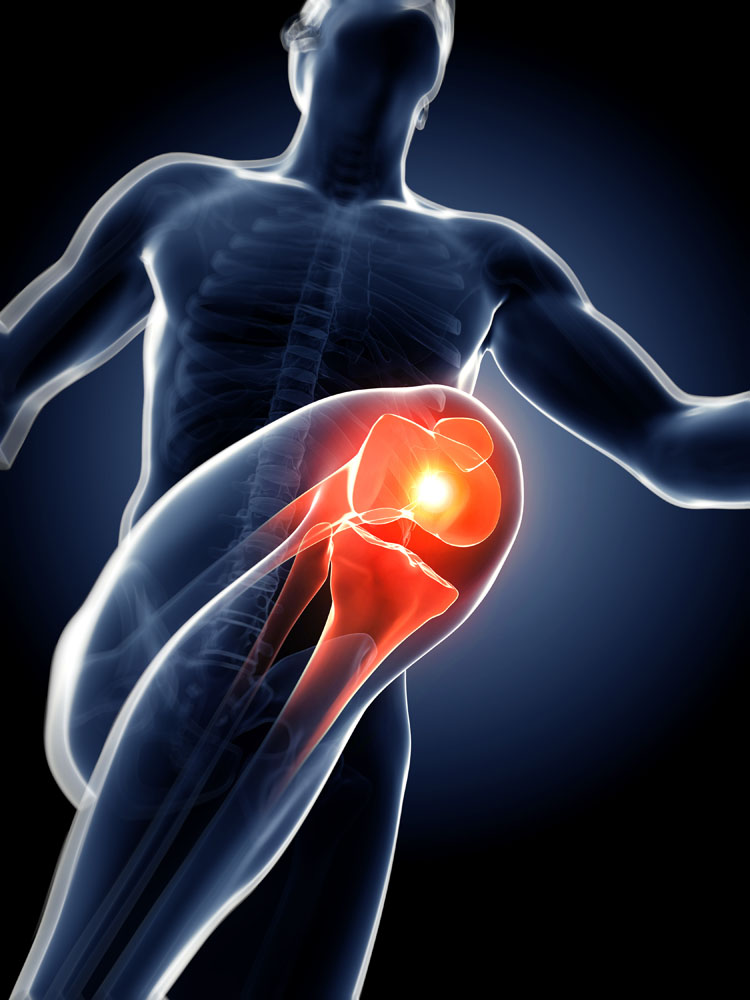 膝关节受风疼痛该怎么办?